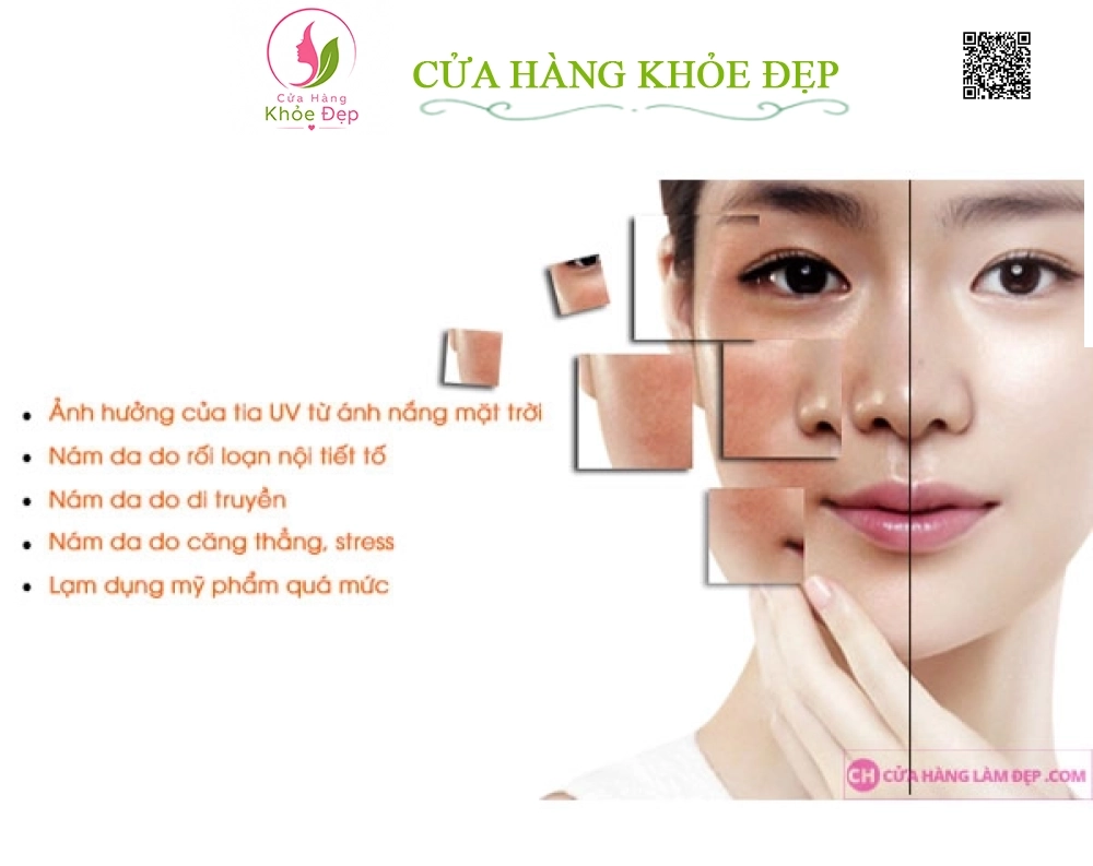 Kem Mờ Nám, Trắng Da An Toàn Wcare With Nano