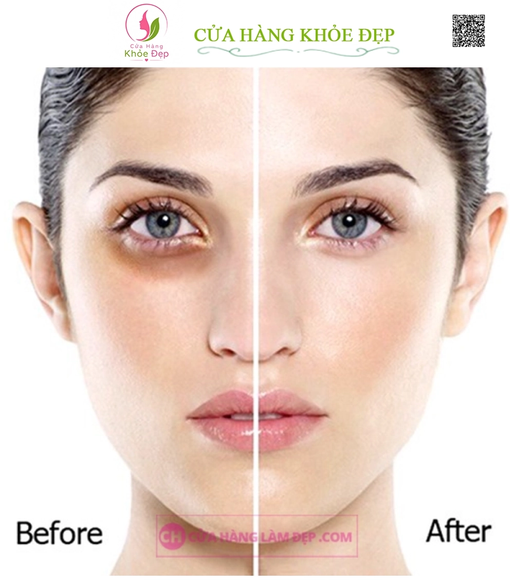 Kem Dưỡng, Điều giảm Nếp Nhăn, Quầng Thâm Và Bọng Mắt Thalgo Silicium Eye Cream