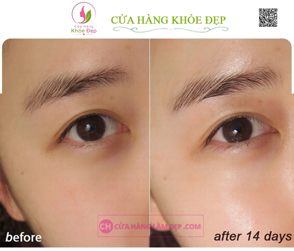 Viên Uống Cấp Nước Collagen Hàn Quốc Innerb Aqua Rich 70 Viên