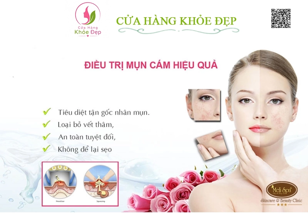 Chăm Sóc Da Mặt Dành Cho Da Nám - Tàn Nhang tại Meli Spa