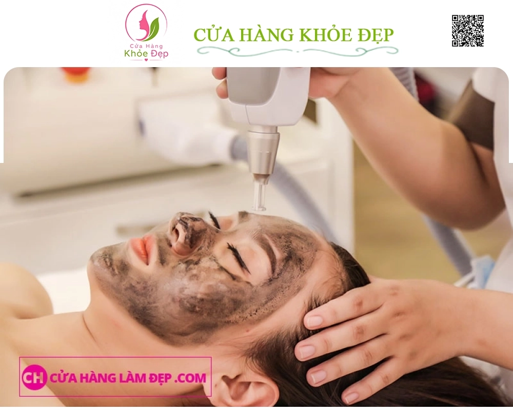 Bắn Carbon Mờ Thâm - Nám - Trẻ Hoá Da tại Meli Spa