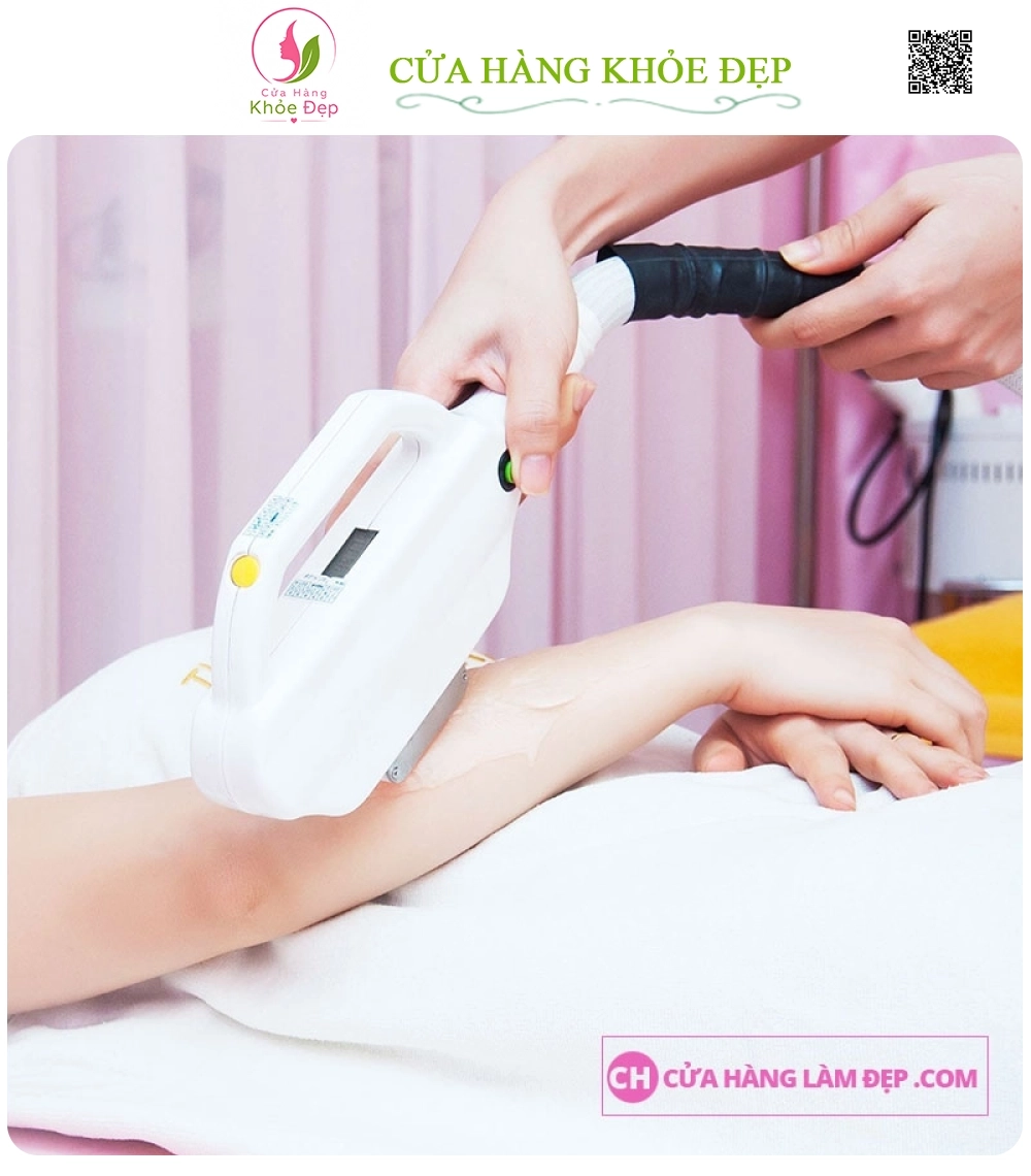 Liệu Trình Triệt Lông Tay Tại Melispa