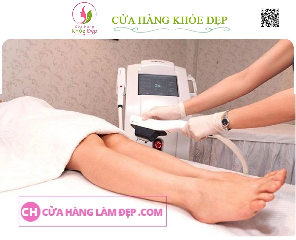 Liệu Trình Triệt Lông Chân Tại MeliSpa