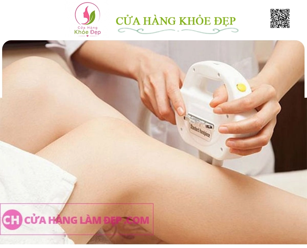 Liệu Trình Triệt Lông Chân Tại MeliSpa
