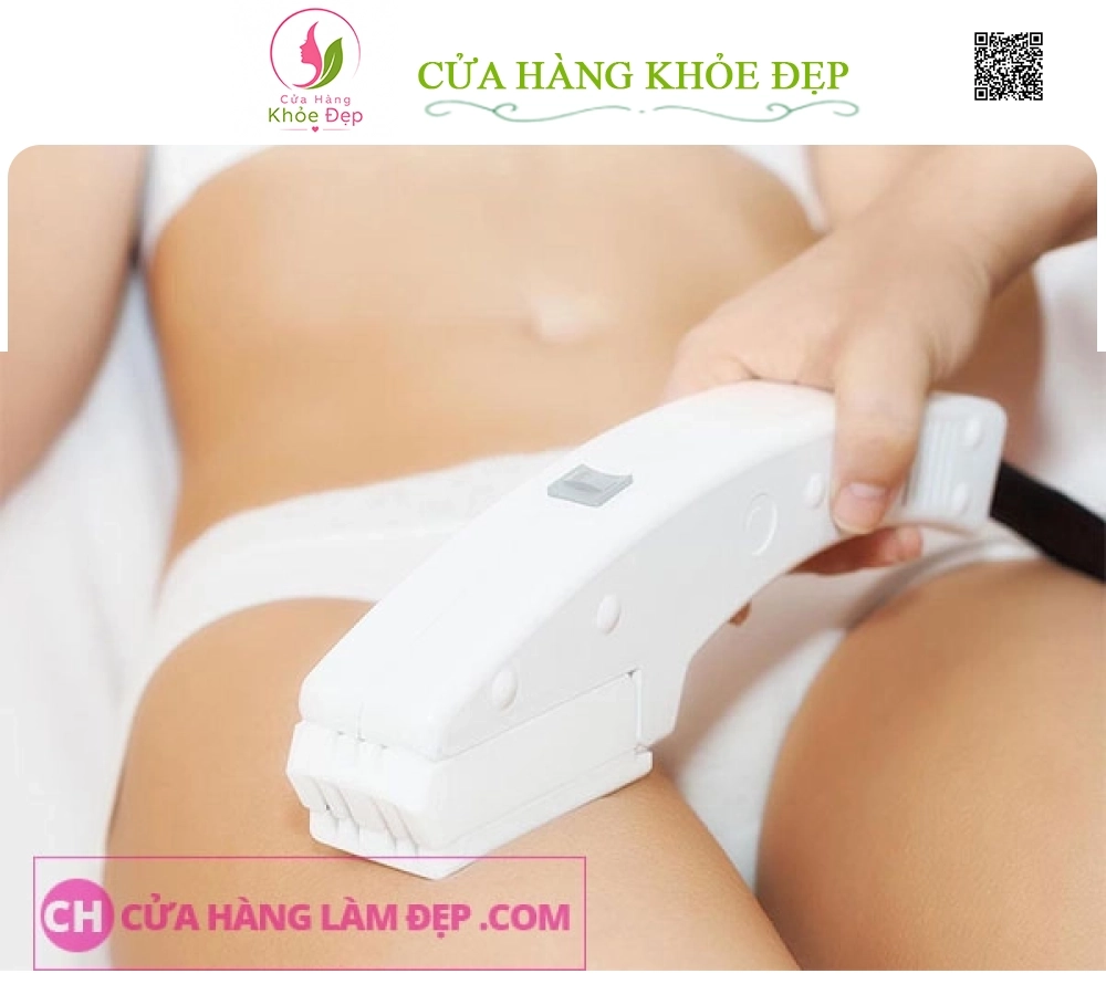 Triệt Lông Bikini Tại MeliSpa