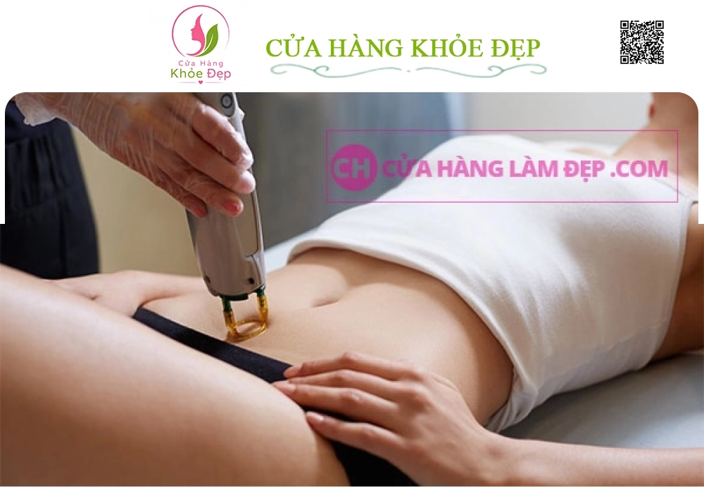 Triệt Lông Bikini Tại MeliSpa