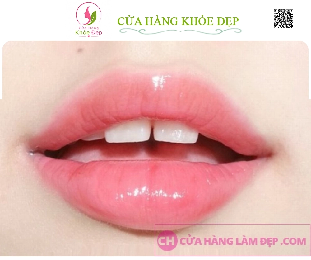 Phun Môi Pha Lê, Căng Bóng Công Nghệ Châu Âu tại Meli Spa