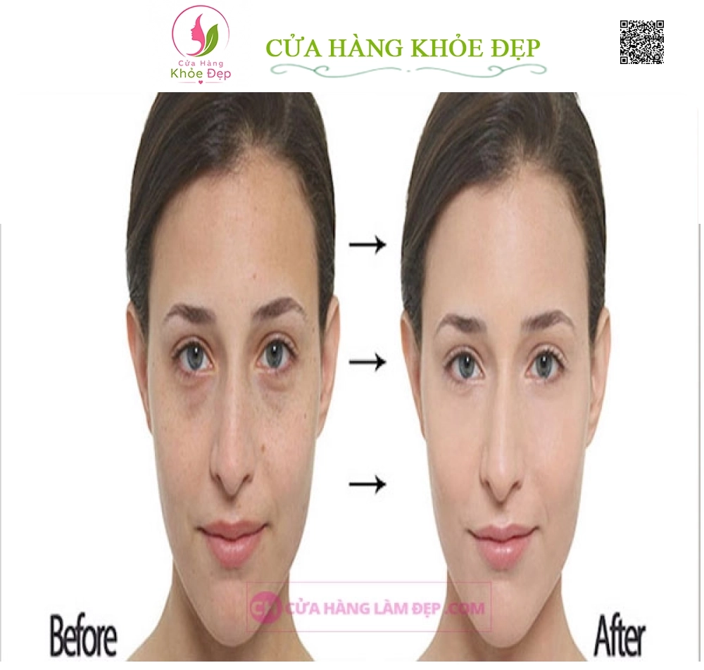 Mặt Nạ Tái Tạo Da Muarad Intensive-C Radiance Peel
