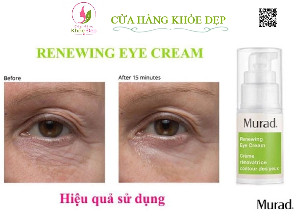 Kem Giảm Bọng Mắt, Quầng Thâm Murad Renewing Eye Cream