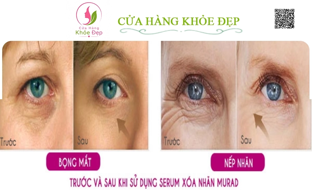 Serum Nâng Cơ Và Xoá Nhăn Vùng Mắt Murad Intensive Wrinkle Reducer® For Eyes