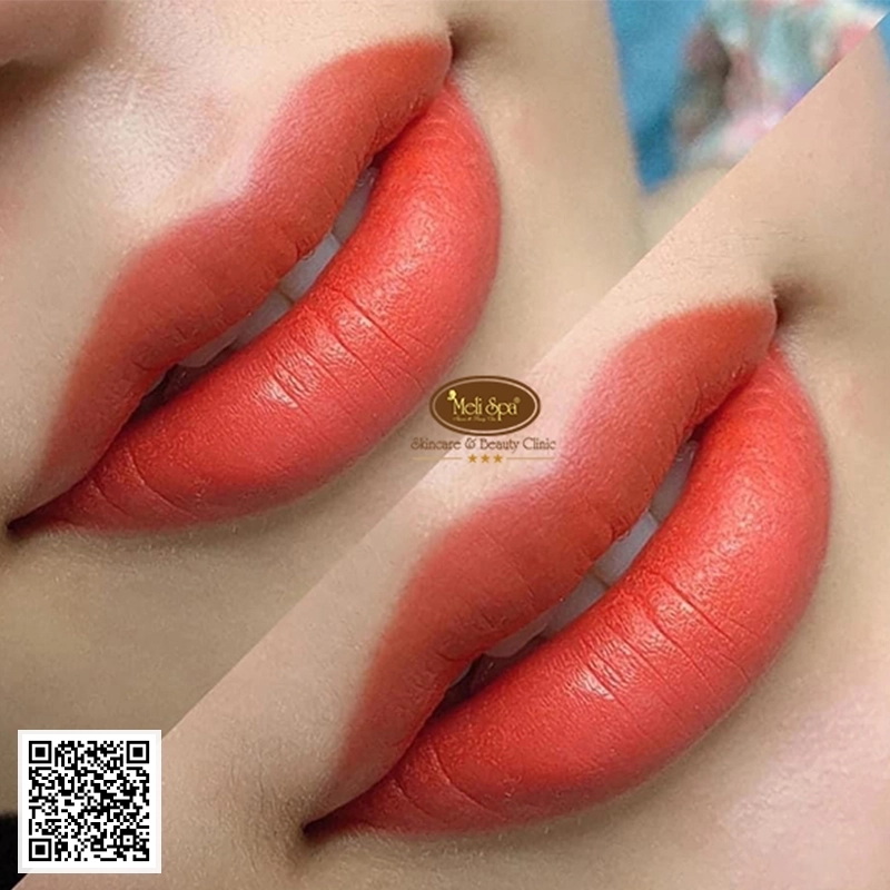 Phun Môi Rubylip Công Nghệ Mới Nhất Tại MeLiSpa