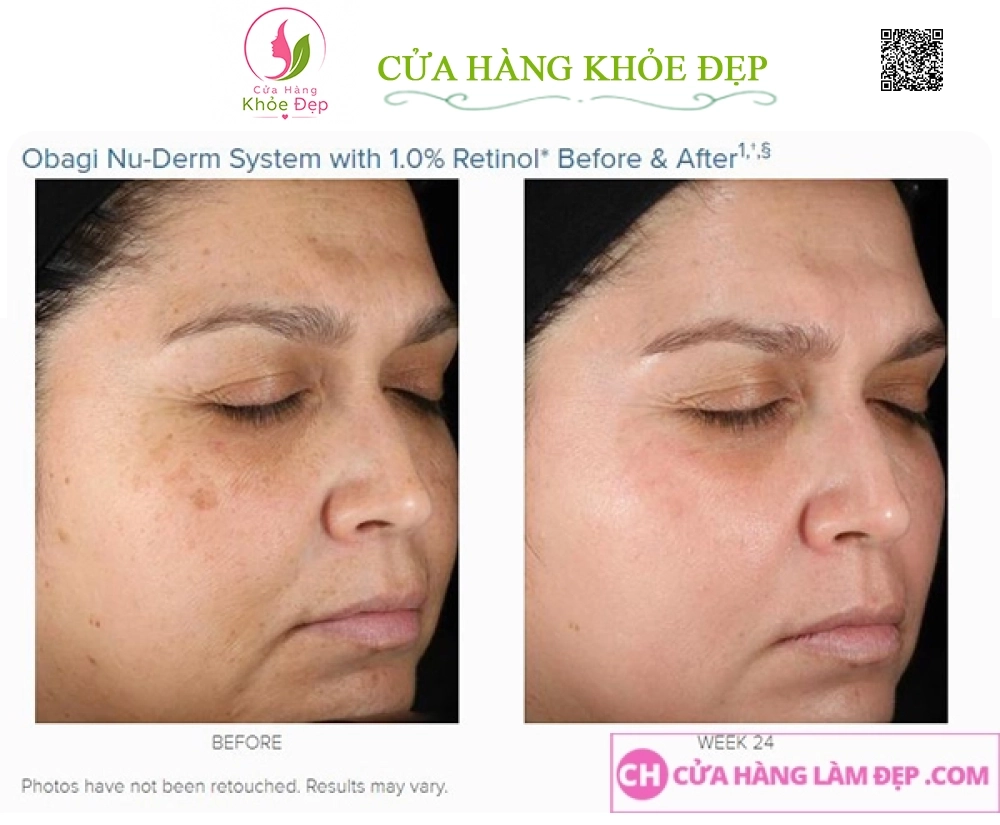 Kem dưỡng da trẻ hóa, ngừa mụn,cân bằng sắc tố da Obagi 360 Retinol 0.5%