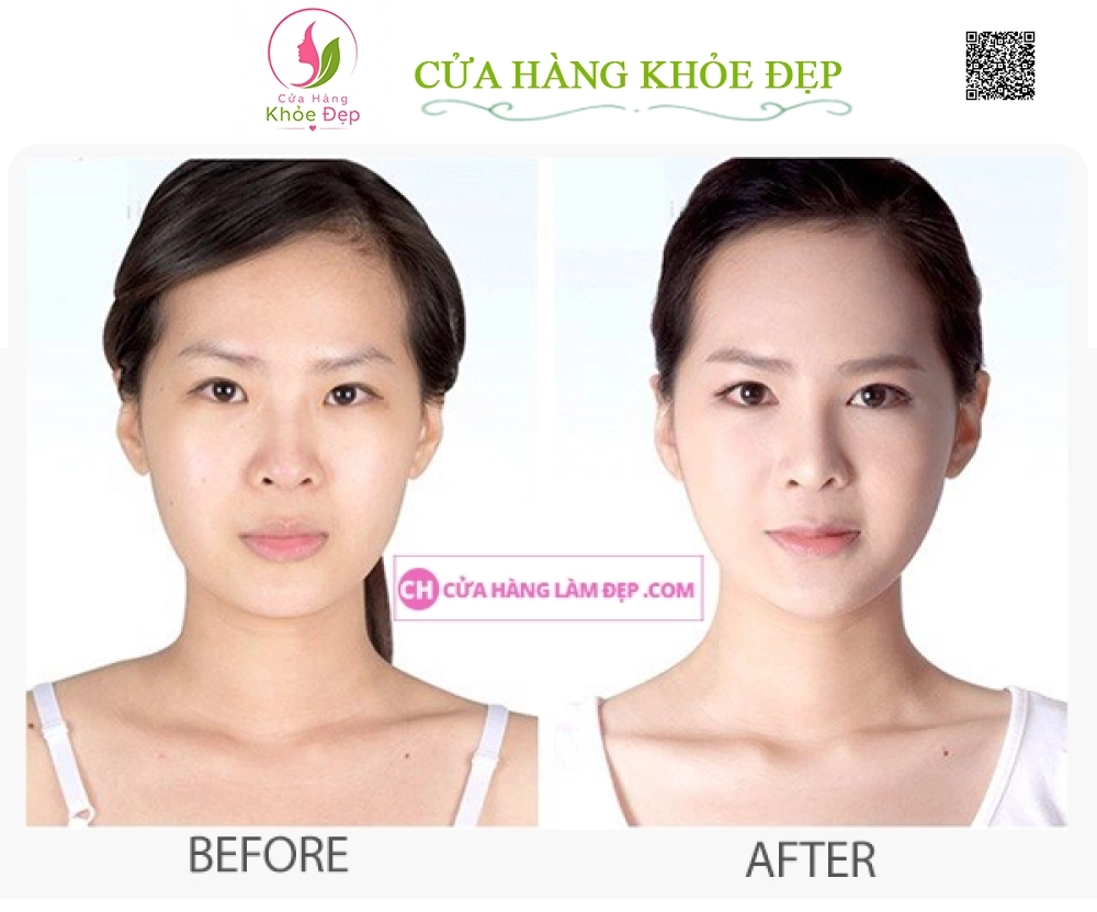 Kem Dưỡng Ẩm, Hỗ Trợ Ngừa Lão Hóa Obagi Gentle Rejuvenation Skin Calming Cream